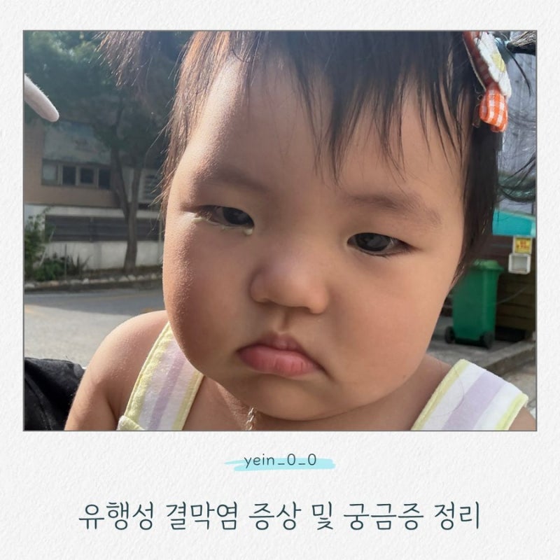 유행성 결막염인 줄 알았는데 아니었어요｜13개월 아기 두 병원 진료 후기