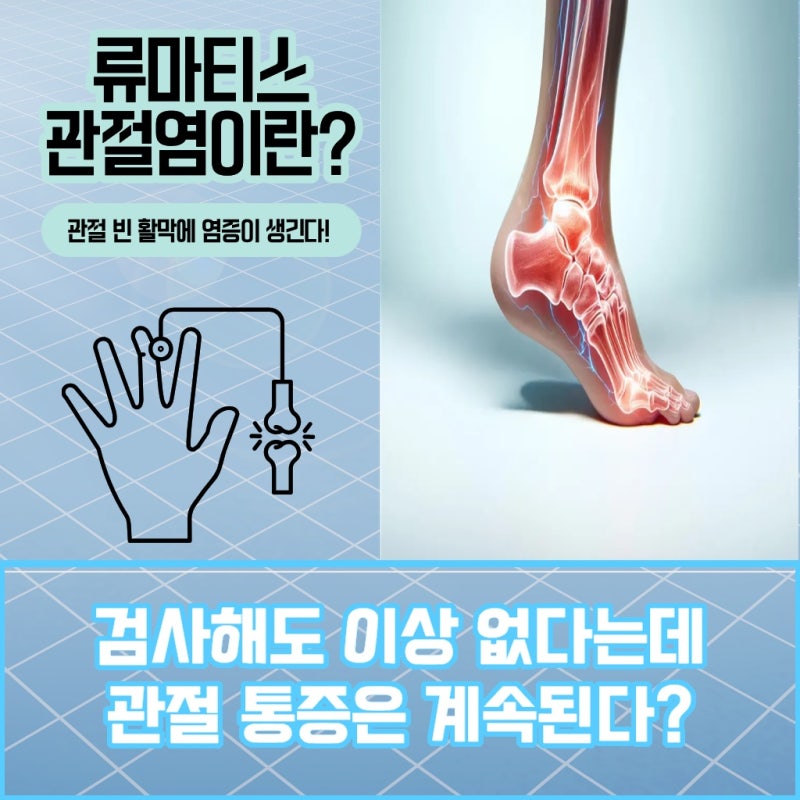 류마티스 관절염 피 검사 언제 필요할까요?