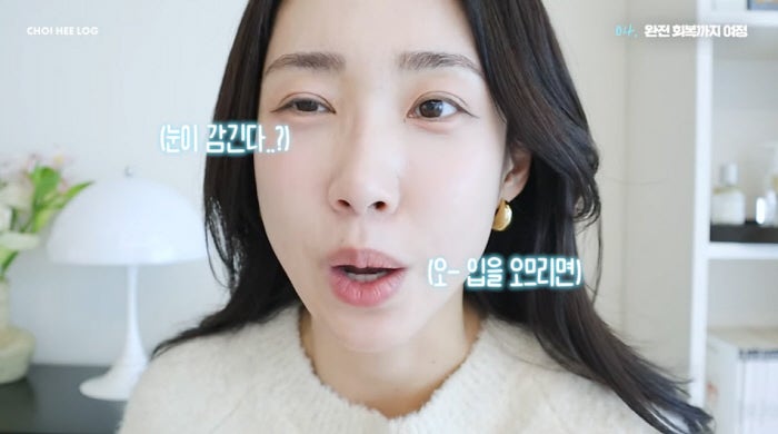 "눈도 안 감겼다"…안면마비 고백한 최희, 최근 전한 뜻밖의 근황