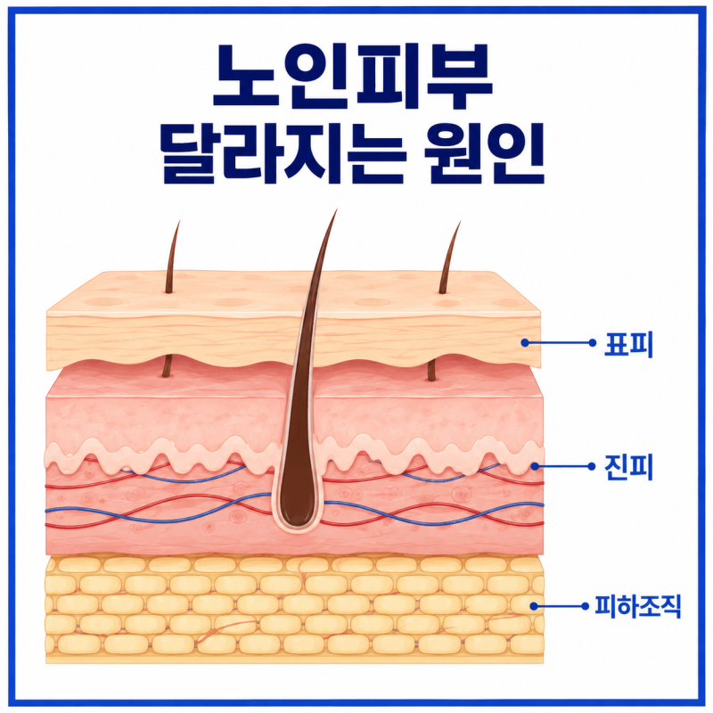 노인 피부 가려움과 검버섯, 단순한 노화일까? 원인부터 피부질환·예방법까지