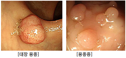 건강검진 필수 체크!!!