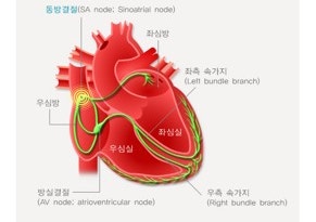 심장이 느리게 뛰는 '서맥', 치료법 인공심박동기 시술 및 주의사항 총정리
