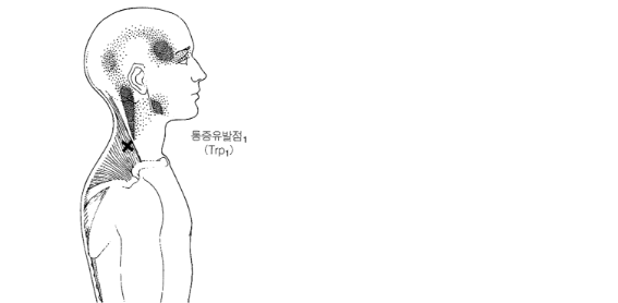 [해부학] 승모근(Trapezius) — 목·어깨 통증의 지배자