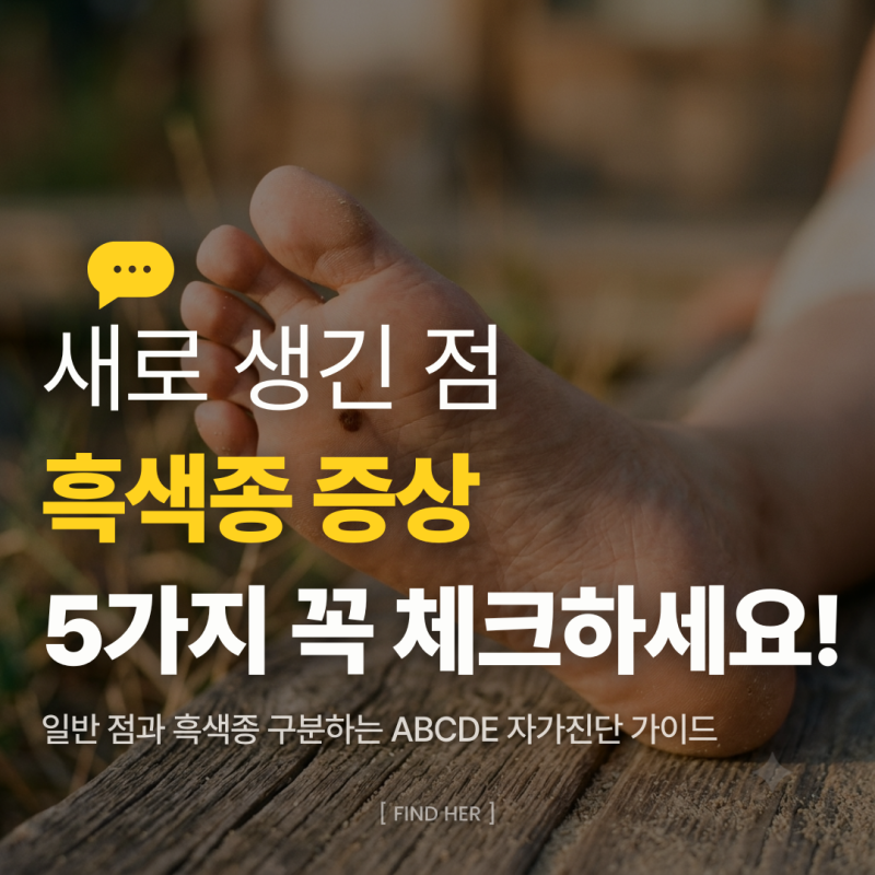 흑색종 증상, 단순 점인 줄 알고 넘겼다면? 점 흑색종 구분하는 ABCDE 5가지 자가진단법