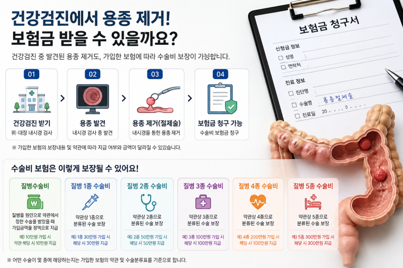 건강검진 대장내시경 용종제거, 보험금 받을 수 있을까? 수술비 청구 총정리
