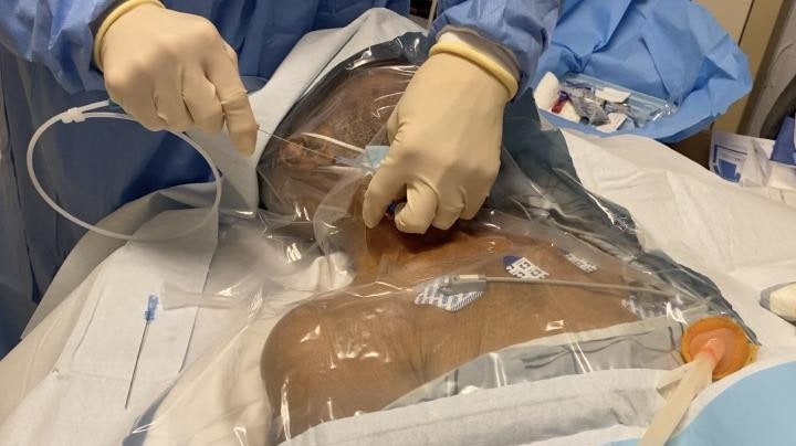 Ventilator 환자 C-line 삽입할 때 왜 PEEP을 잠깐 0으로 할까?
