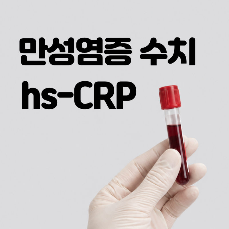 내 몸속 만성염증 지표 hs-CRP 수치 높으면 위험할까? 뜻부터 검사 비용 병원 정리