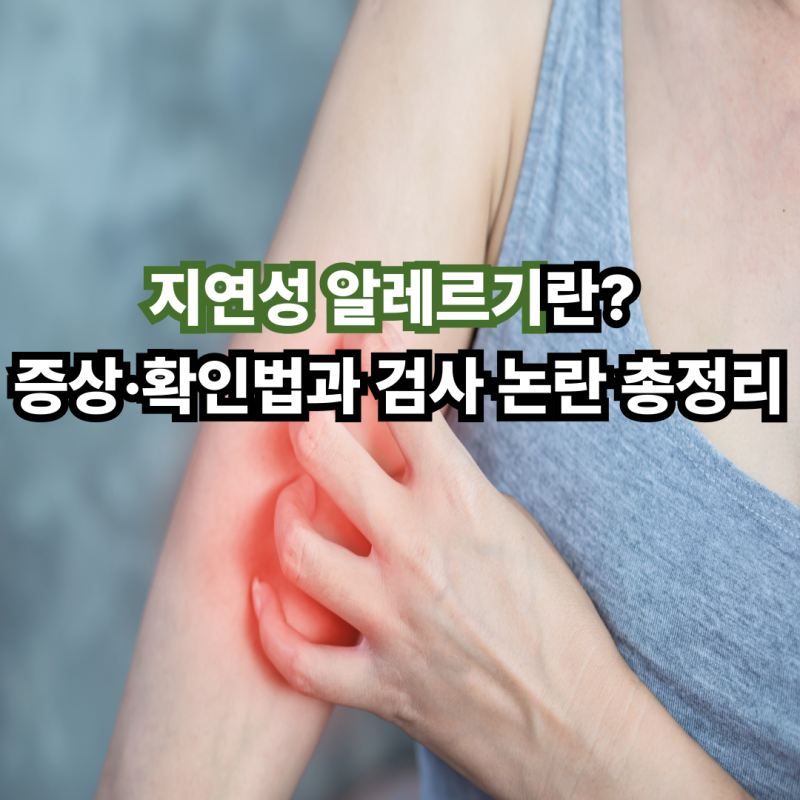 지연성 알레르기란? 증상·확인법과 검사 논란 총정리