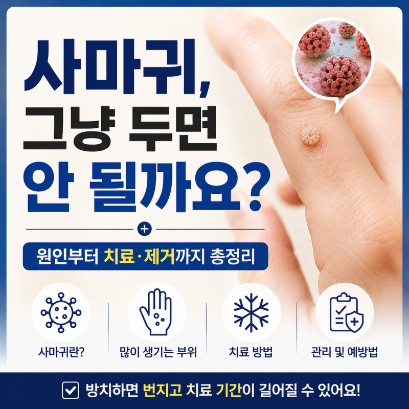 사마귀, 그냥 두면 안 될까요? 원인부터 치료·제거까지 총정리
