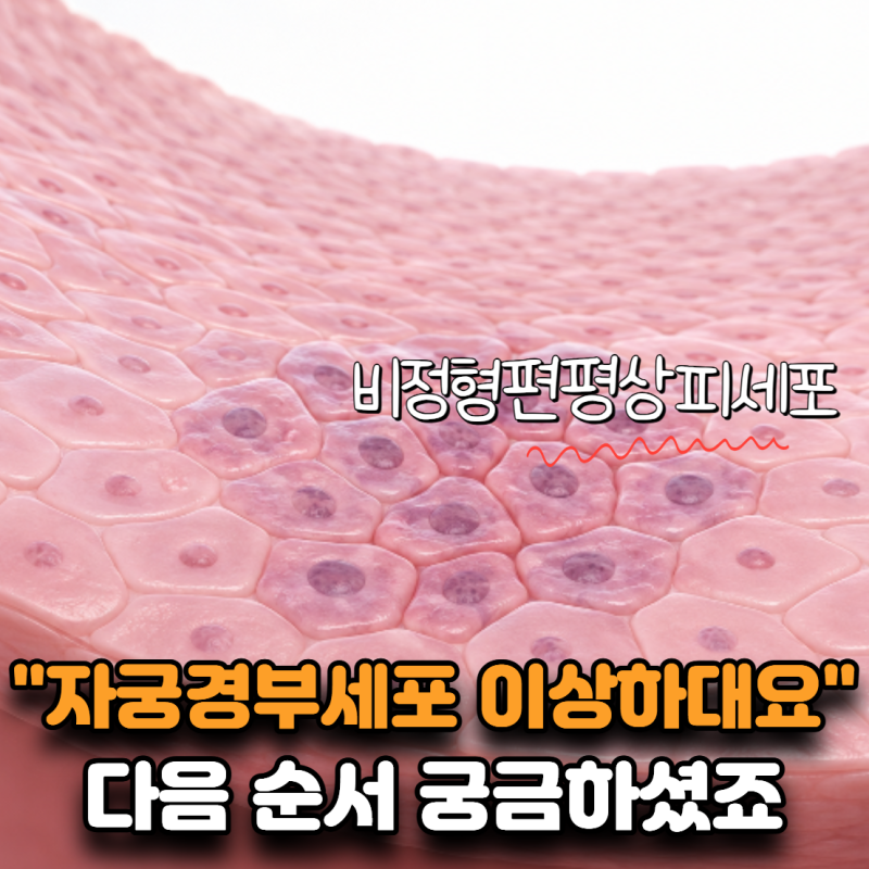 “자궁경부 세포가 이상하대요” 비정형편평상피세포, 다음 순서는?