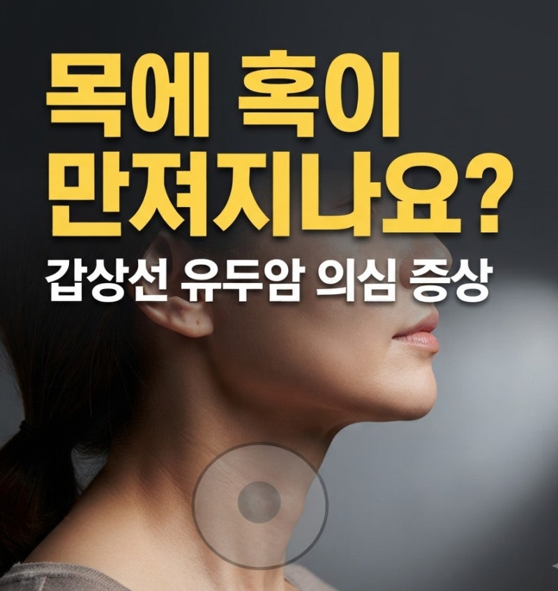 목에 만져지는 혹? 흔하지만 착한 암 '갑상선 유두암' 증상과 특징 총정리
