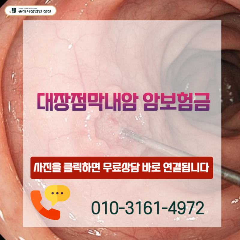 대장점막내암 암보험금, D01 진단받았다면 일반암 전액 수령 가능할까?