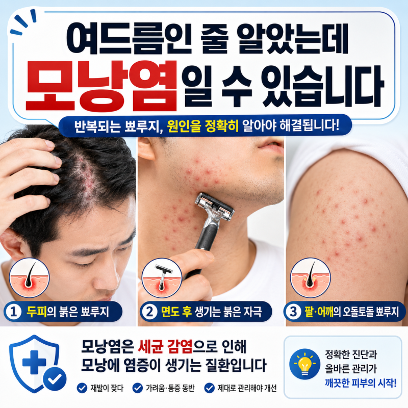 엉덩이, 두피, 면도한 자리에 뾰루지가 반복된다면, 여드름이 아니라 모낭염일 수 있습니다.