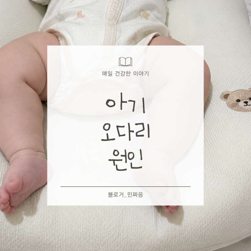아기 다리가 휘어 보여요 정상 오다리와 확인해야 할 증상
