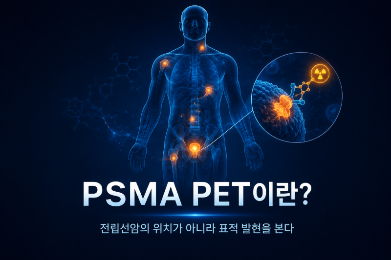 PSMA PET이란?｜전립선암의 위치가 아니라 ‘표적 발현’을 보는 영상｜Theranostics4