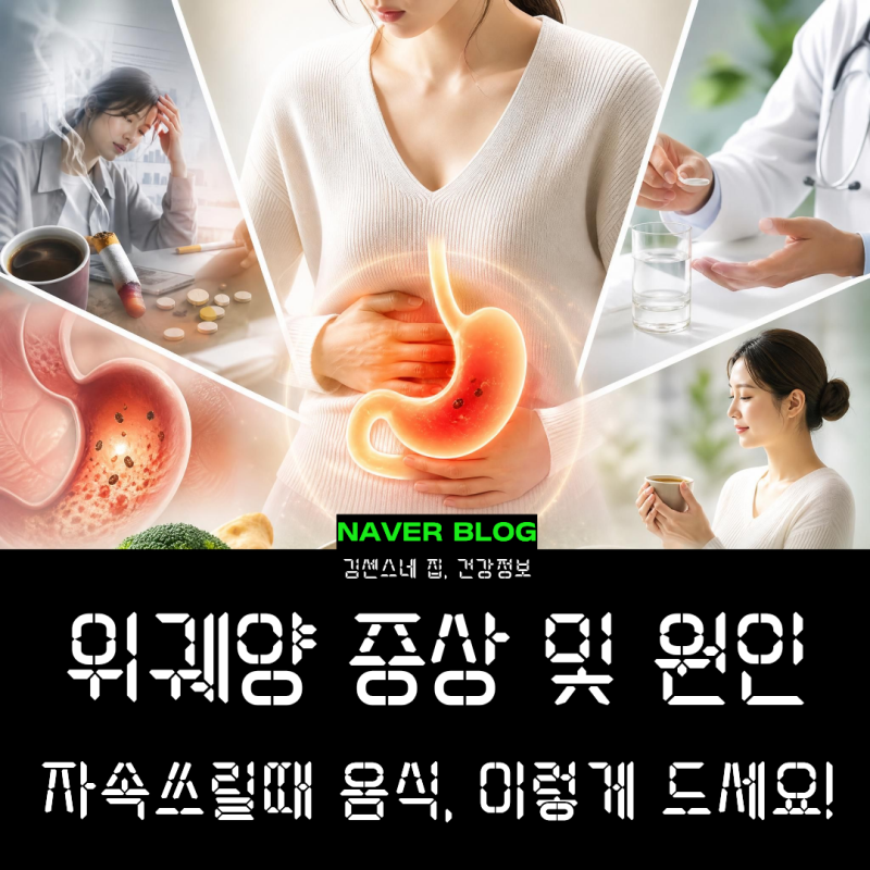 위궤양 증상 원인 및 치료, 속쓰릴때 음식 섭취 가이드