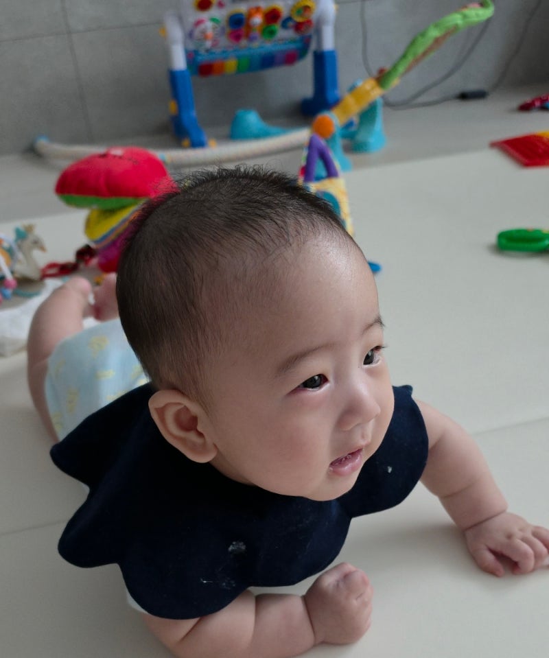아기 눈 부음, 안검염 증상과 병원 진료 후기