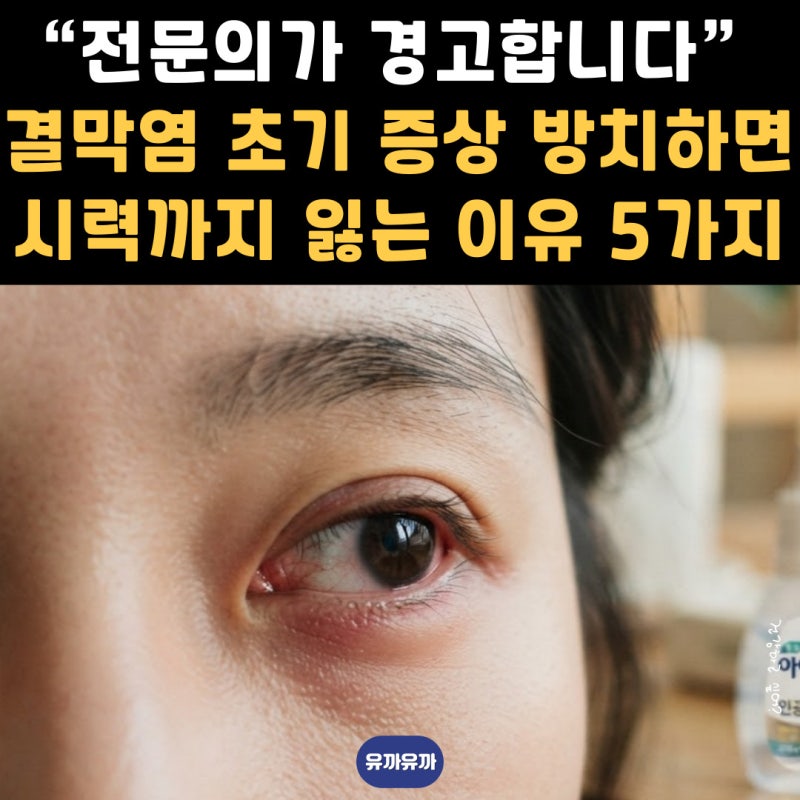 “전문의가 경고합니다” 결막염 초기 증상 방치하면 시력까지 잃는 이유 5가지