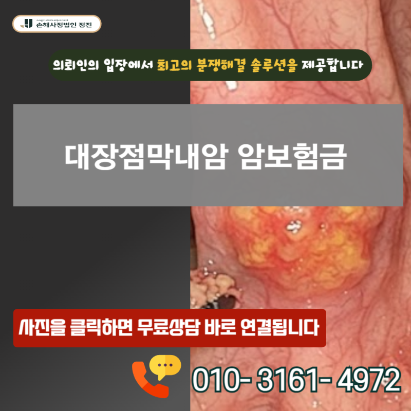 대장점막내암 암보험금, D01 질병코드인데 정말 일반암으로 못 받나요?