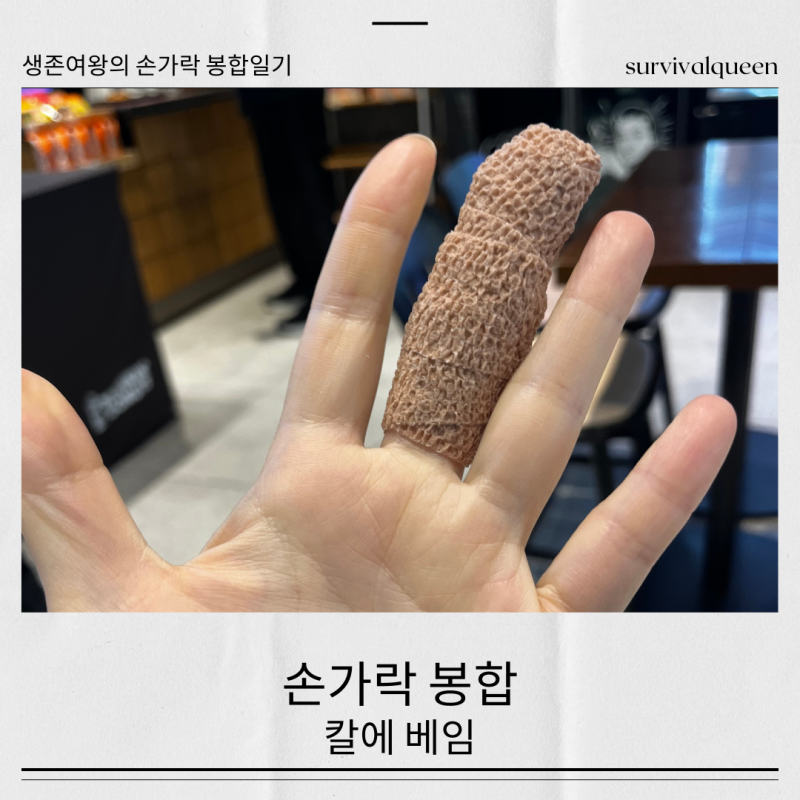 손가락 베였을 때 | 의료용 본드 붙였다가 결국 4바늘 봉합한 후기