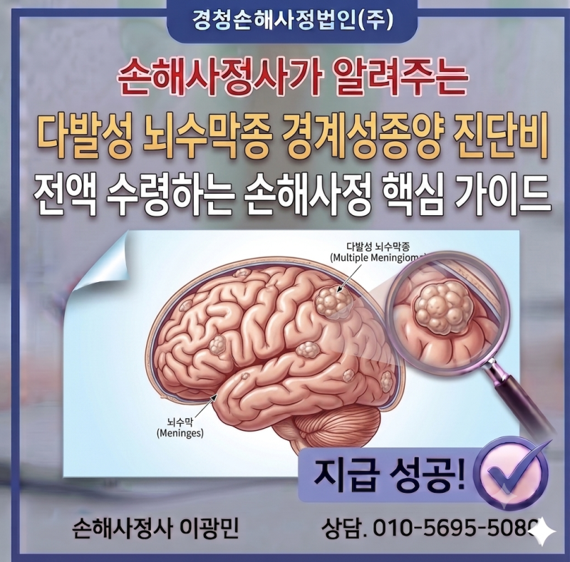 다발성 뇌수막종 경계성종양 진단비 전액 수령하는 손해사정 핵심 가이드