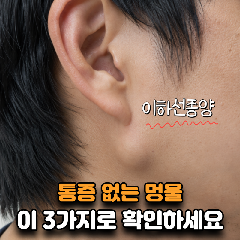 “안 아파서 몇 달 넘겼어요” 귀밑 멍울, 이하선종양 신호 3가지