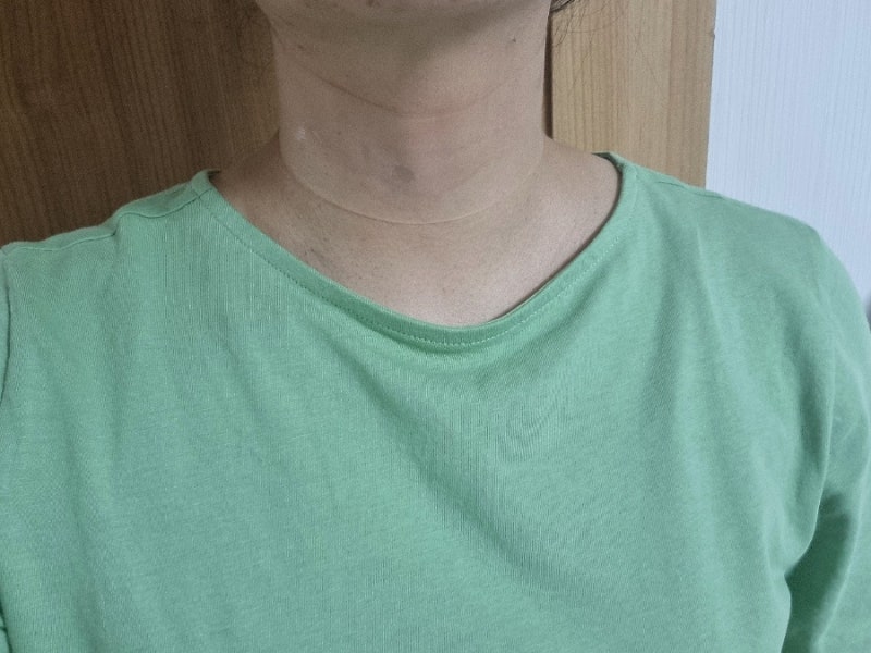 목주름팩 써봄 올킨스 넥테이프 실리콘 목주름패치