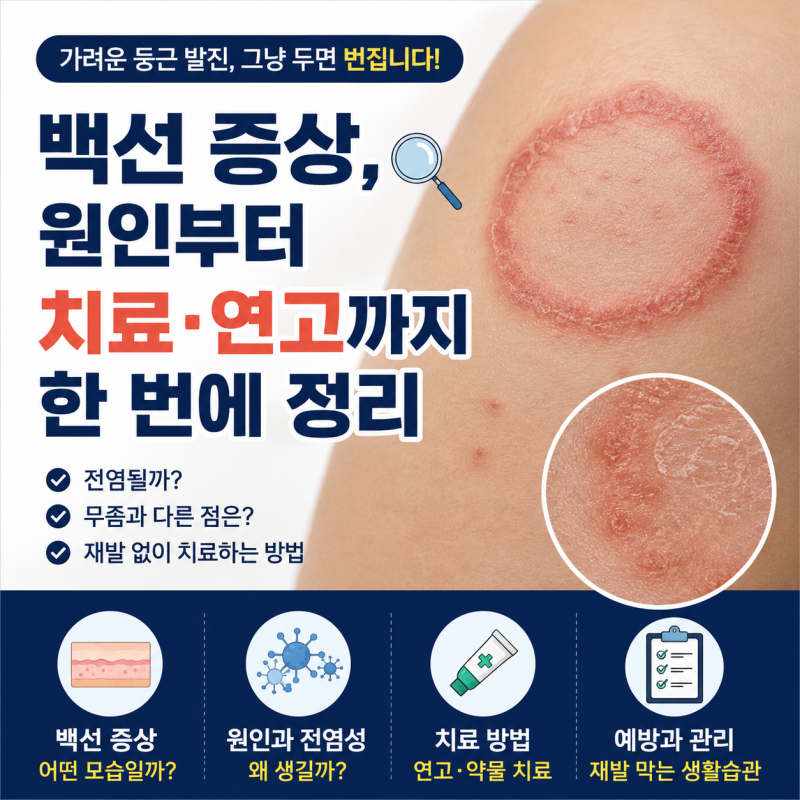 백선 증상, 원인부터 치료·연고까지 한 번에 정리