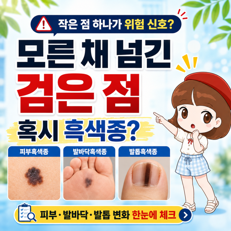 피부흑색종 발바닥흑색종, 발톱흑색종 단순한 점일까? ABCDE 관찰법