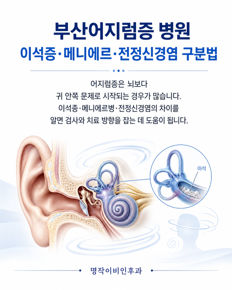 부산어지럼증 병원, 이석증·메니에르·전정신경염 구분법