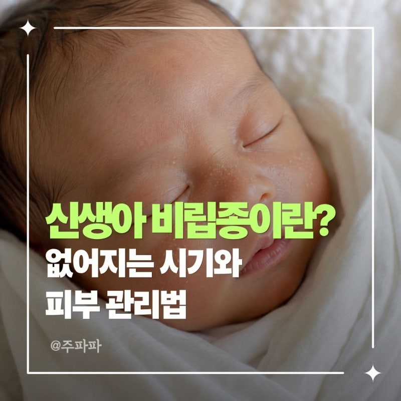신생아 비립종이란? 없어지는 시기와 피부 관리법