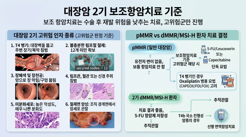 대장암 병기별 항암제 종류와 치료 고위험군 환자 사례