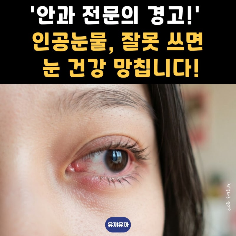 안과 전문의 경고! 인공눈물, 잘못 쓰면 눈 건강 망칩니다! 올바른 사용법 5가지
