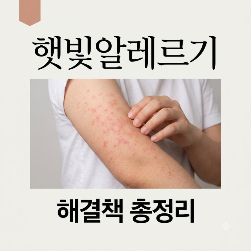 햇빛알레르기 여름철 가려움·발진 해결! 증상부터 연고, 예방까지