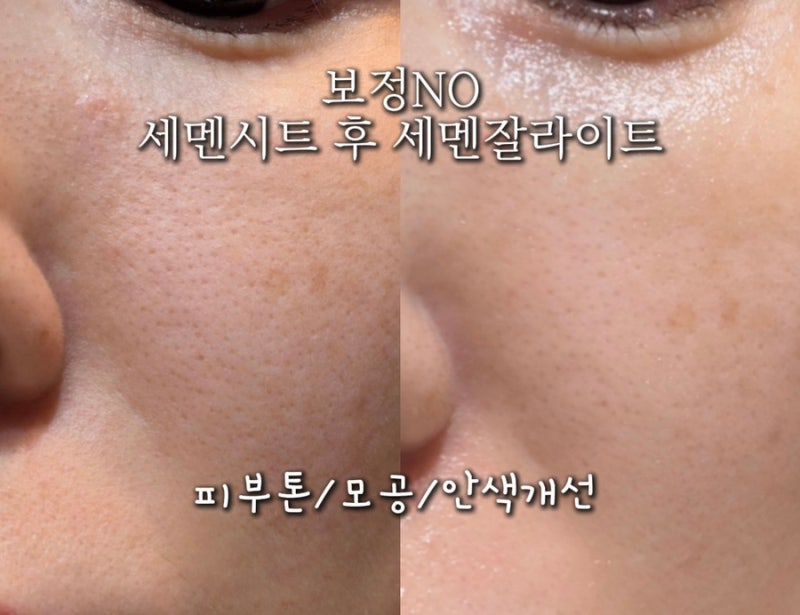 세멘시트 사용법 부작용 내돈내산 올영 모공팩 추천!
