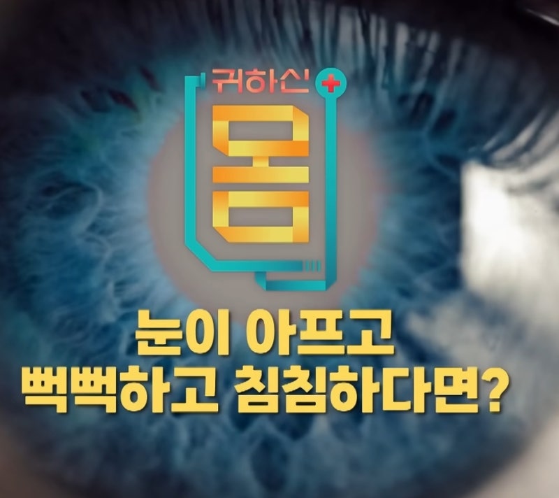눈이 뻒뻑해 죽겠어요? 안구건조증 돈 안들이고 고치는 방법(EBS명의들)