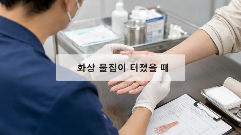 화상 물집 터졌을 때, 이 증상 보이면 병원 가세요