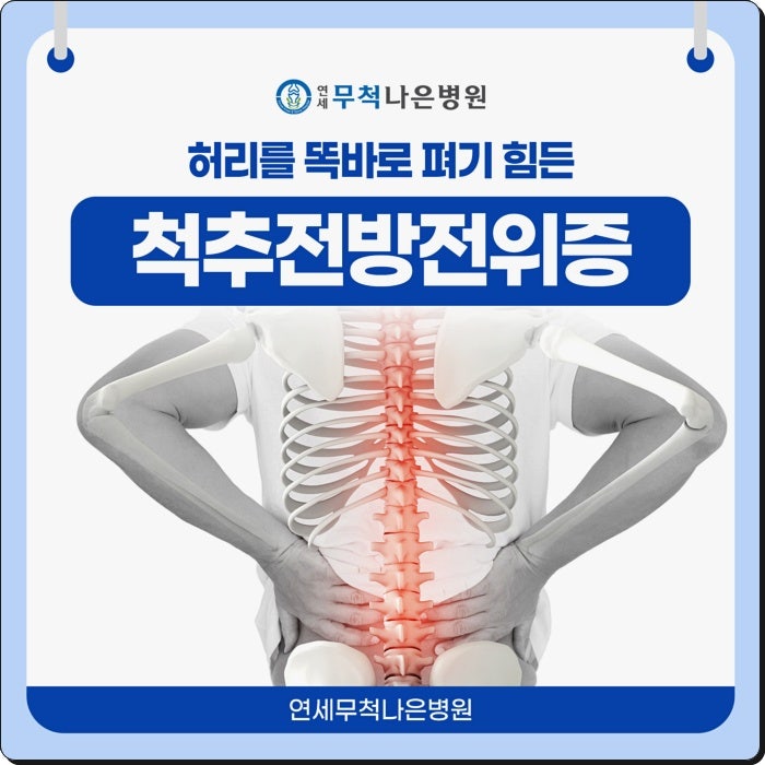 척추전방전위증 수술 언제 고려해야 할까? 비수술로 치료는 안될까?
