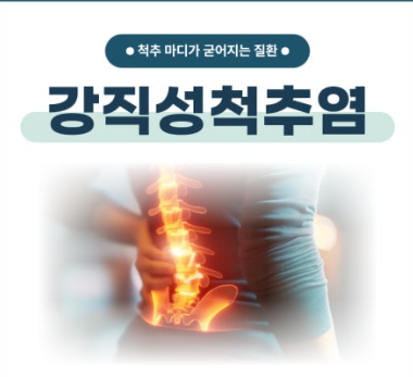 강직성 척추염의 원인과 치료방법