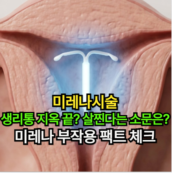 미레나시술, "생리통 지옥 끝? 살찐다는 소문은?" 미레나 부작용 팩트 체크