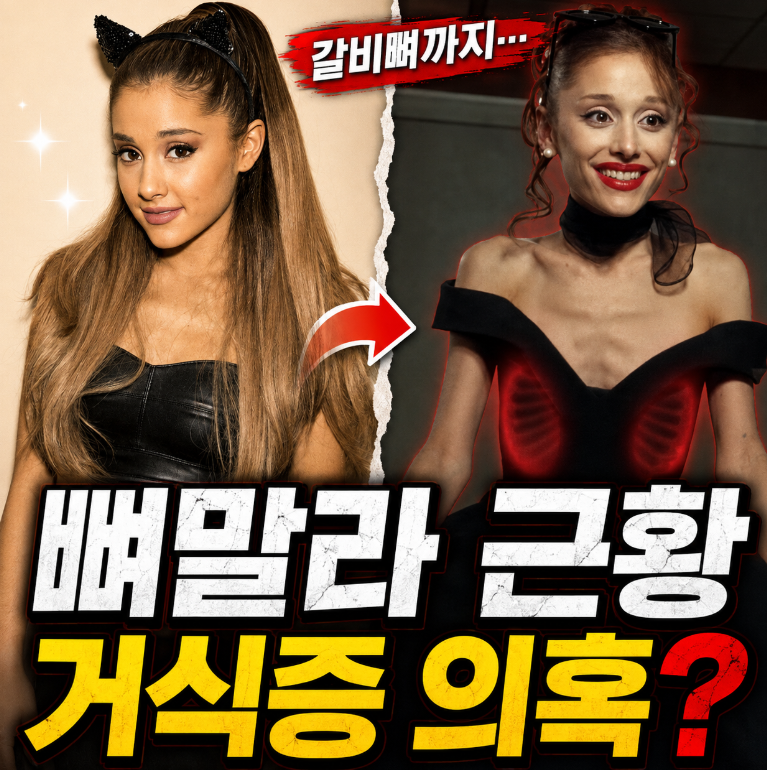 “갈비뼈까지 드러난 뼈말라 근황…” 아리아나 그란데, 또 불거진 거식증 의혹