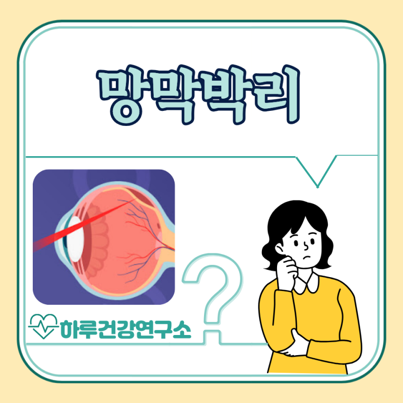 망막박리 증상, 원인, 치료, 수술비 : 실명 가능성