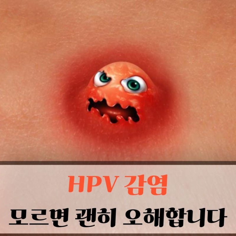 10년간 한 적도 없는데..HPV바이러스 감염? 꼭 알아야 할 원인과 증상