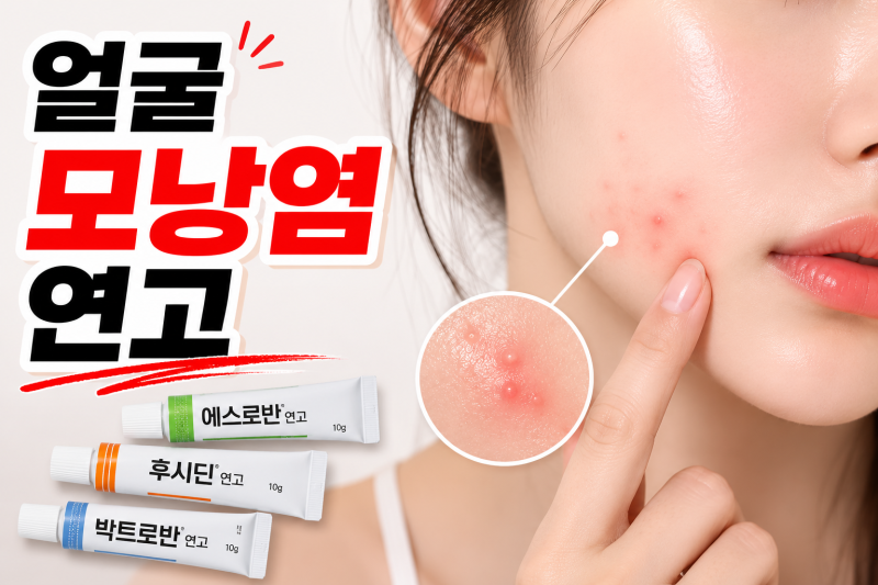 얼굴에 모낭염 생길 때 바르는 약국 모낭염 연고