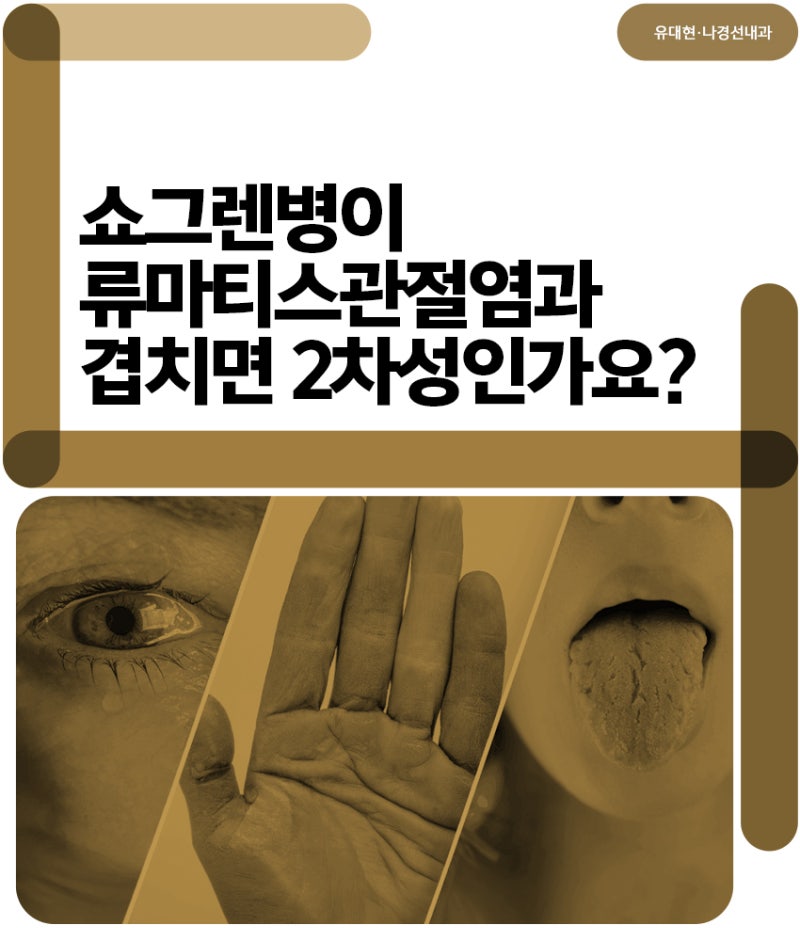 쇼그렌병이 류마티스관절염과 겹치면 2차성인가요?