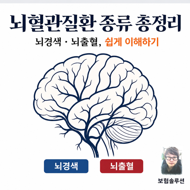 뇌혈관질환 종류 총정리 – 뇌경색·뇌출혈, 쉽게 이해하기