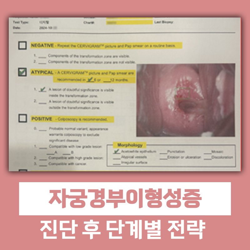 자궁경부이형성증 진단받았다면? 원인·단계·치료 총정리