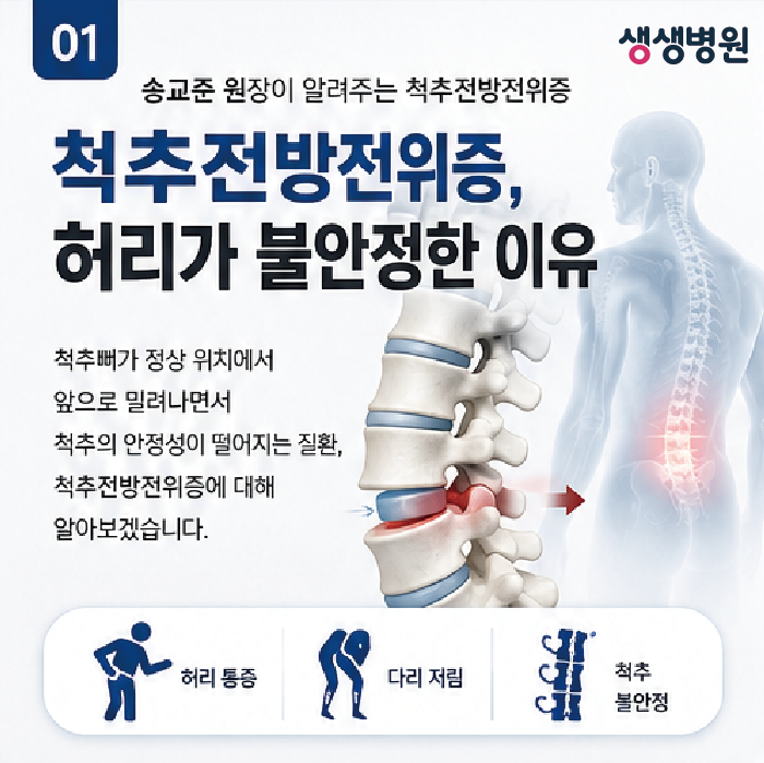 김포 척추병원 | 송교준 원장이 알려주는 척추전방전위증, 허리가 불안정한 이유 부천 생생....