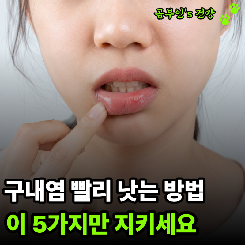혓바늘은 왜 피곤할 때마다 생길까? 알고 보니 "이 변화" 때문이었습니다