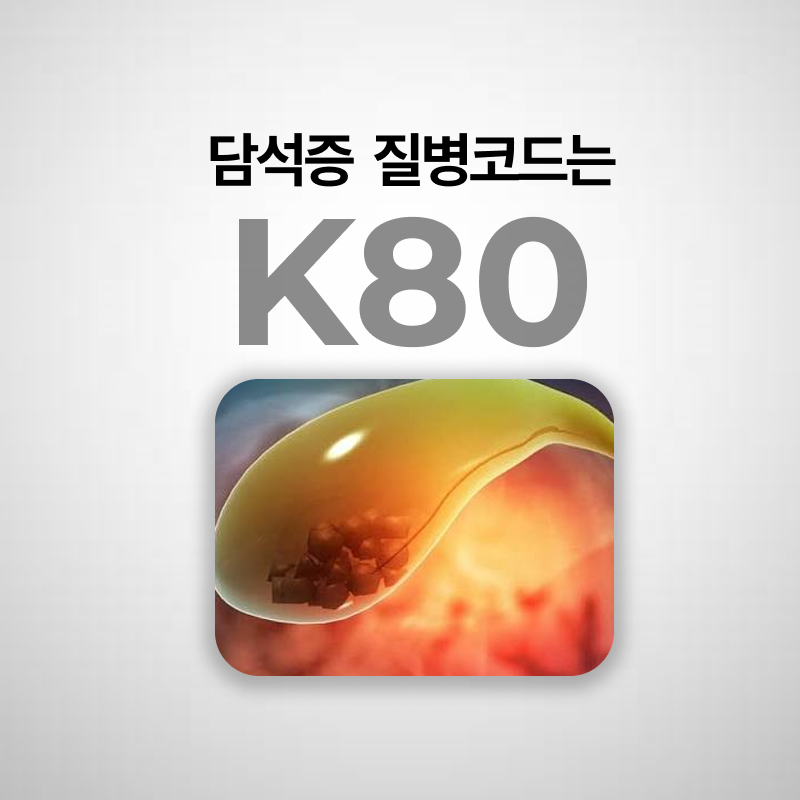 담석증 담낭절제술 수술비 보험청구ㅣ1~7종 수술비